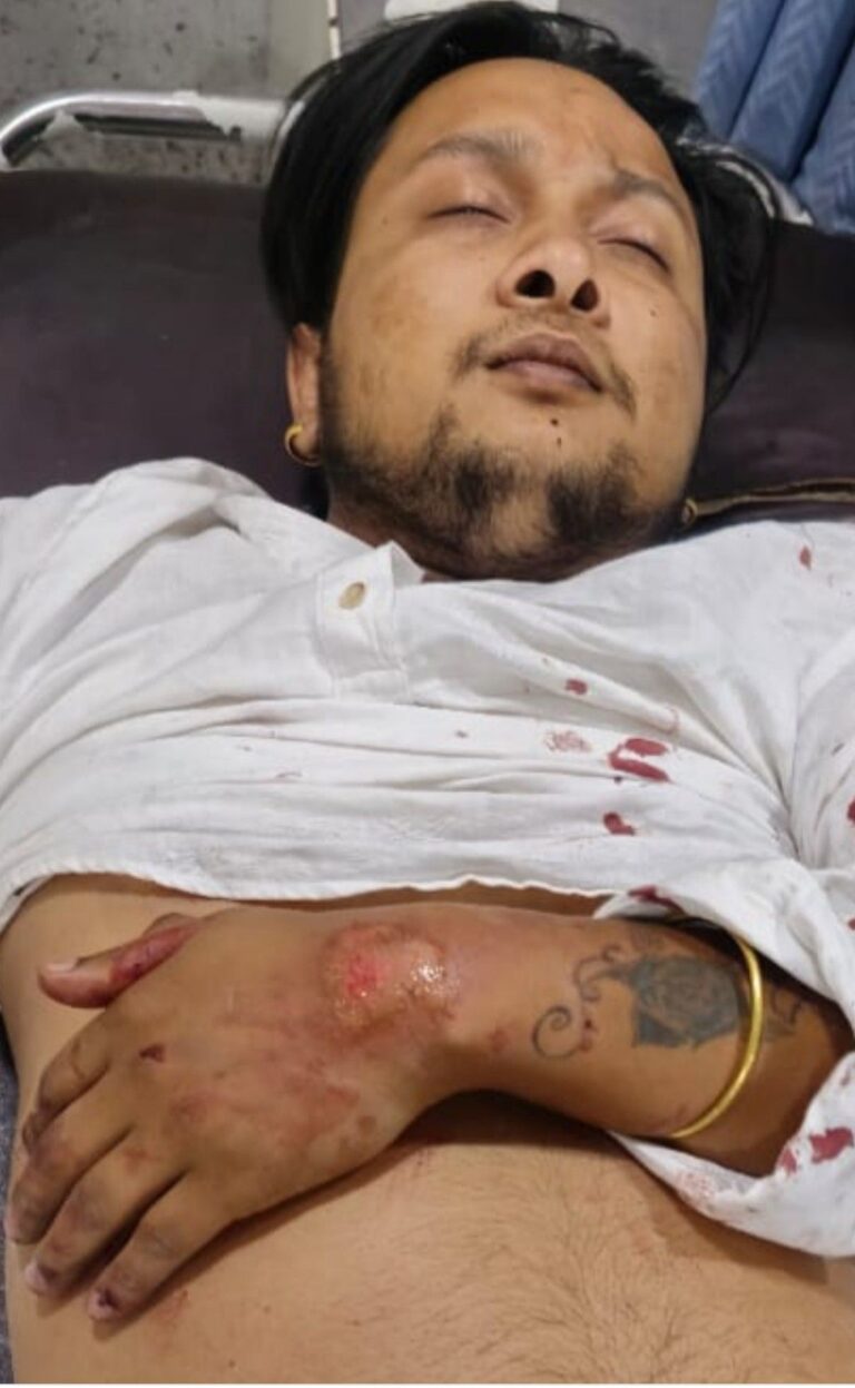 Pawandeep Rajan Axident पवनदीप राजन अब खतरे से बाहर